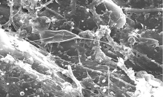 Plàstics a la deriva: com un contaminant origina un nou ecosistema