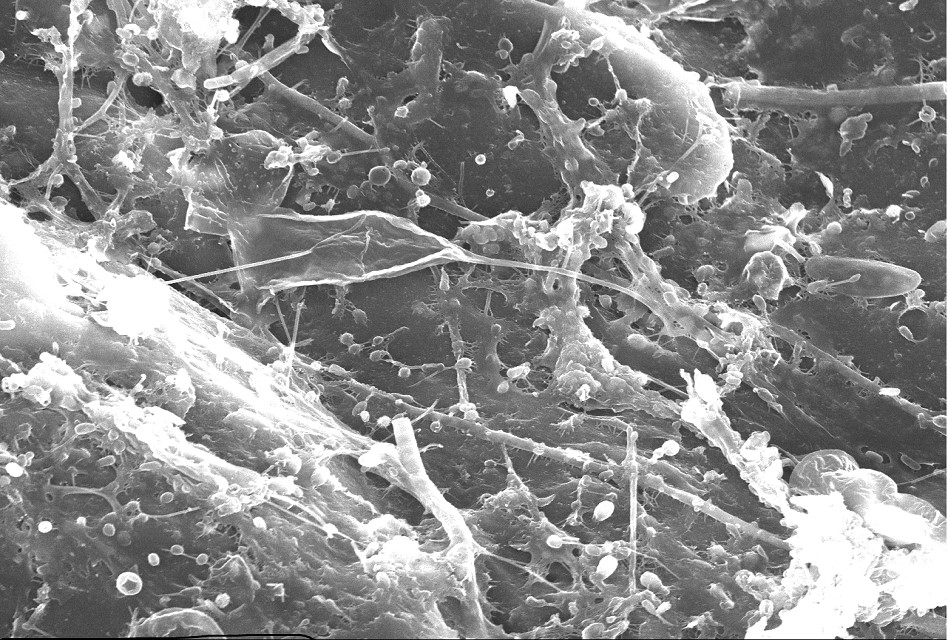 Plàstics a la deriva: com un contaminant origina un nou ecosistema<span class="wtr-time-wrap block after-title"><span class="wtr-time-number">5</span> min de lectura</span>